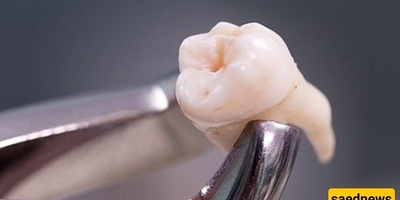 What Effect Does Chewing Food Have on Teeth?