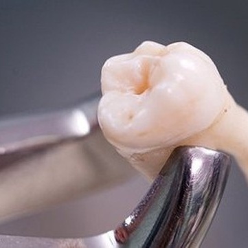 What Effect Does Chewing Food Have on Teeth?