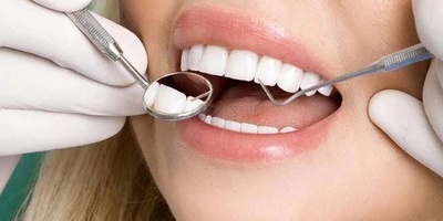 Why Does Dental Composite Chip? Causes and Repair Solutions