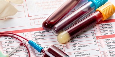 Link Between Metabolic Syndrome and Cancer Risk