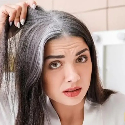 6 Scientific Techniques to Prevent Premature Graying – A Must-Read for Anyone Under 40