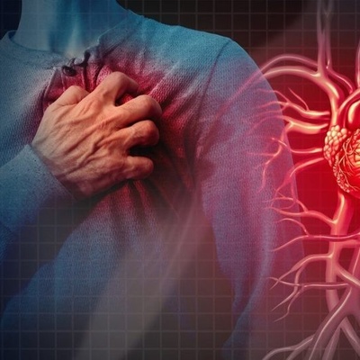 Causes of Heart Problems and Ways to Prevent Cardiovascular Disease