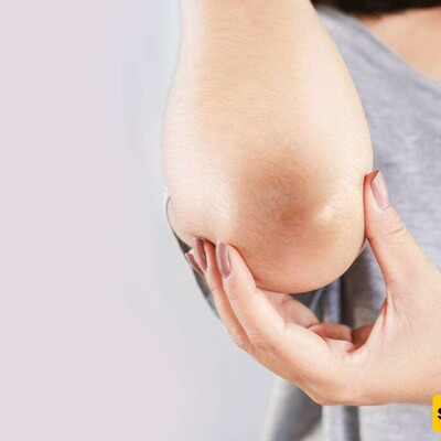 Say Goodbye to Dark Elbows and Knees with These 4 Simple Home Remedies