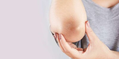 Say Goodbye to Dark Elbows and Knees with These 4 Simple Home Remedies