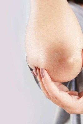 Say Goodbye to Dark Elbows and Knees with These 4 Simple Home Remedies