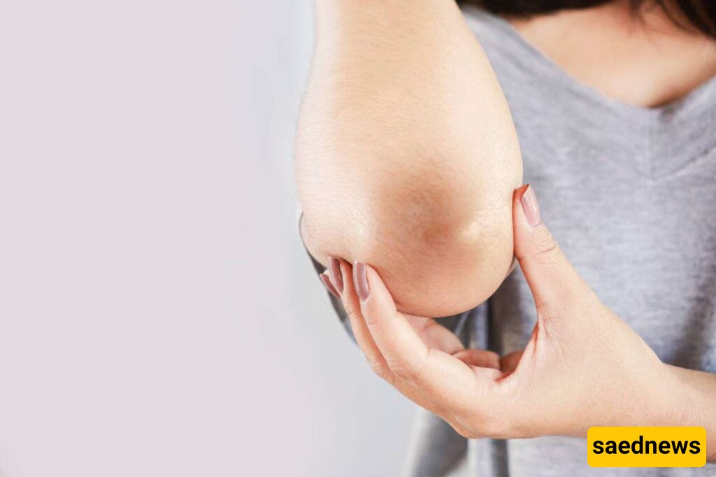 Say Goodbye to Dark Elbows and Knees with These 4 Simple Home Remedies