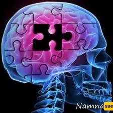 Alzheimer’s and Artists