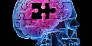 Alzheimer’s and Artists