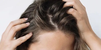 Why Is the Scalp Oily but the Hair Dry?