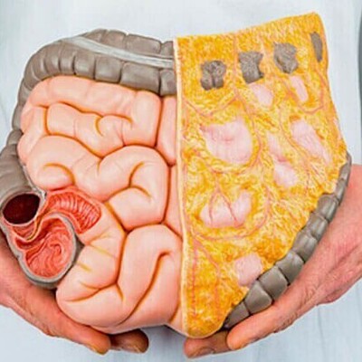 Laxigel (Magnesium Hydroxide Syrup): Uses, Side Effects, and Precautions
