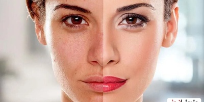 Miracle Methods to Whiten Your Skin in One Day + Tips for Achieving Fair, Radiant Skin