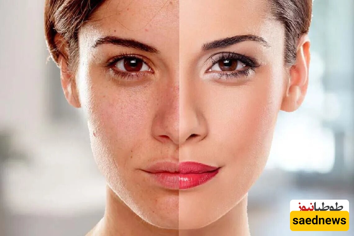 Miracle Methods to Whiten Your Skin in One Day + Tips for Achieving Fair, Radiant Skin