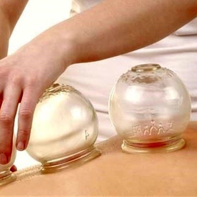 People Who Should Never Undergo Cupping Therapy