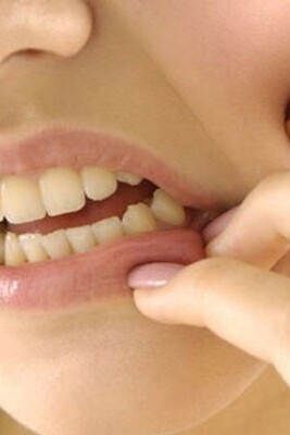 Dentol Drops: Uses and Side Effects