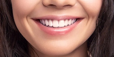 What Are the Side Effects of Dental Composite Bonding and Is It Harmful to Your Teeth?