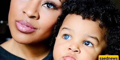 A Glimpse into the Remarkable Eyes of a Mother and Her Son with a Rare Genetic Disorder [Photos]