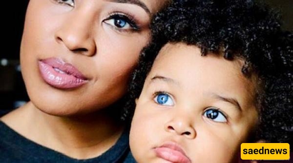 A Glimpse into the Remarkable Eyes of a Mother and Her Son with a Rare Genetic Disorder [Photos]