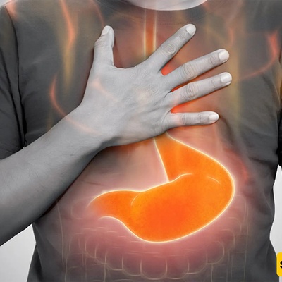 Relieve Acid Reflux with These Foods