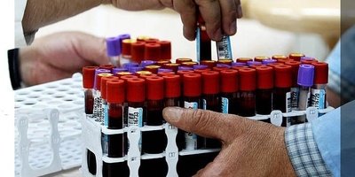 The Rarest Blood Type in the World, Found in Only Three People on Earth