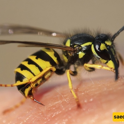 15-Centimeter Bee Attacks a Woman!!