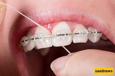 The traditional flossing method