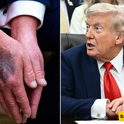 Report On Trump’s Health And The Ambiguities That Were Not Clarified