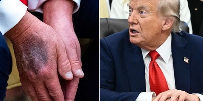 Report On Trump’s Health And The Ambiguities That Were Not Clarified