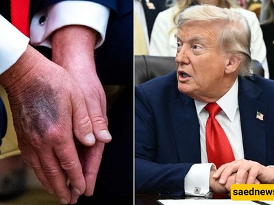 Report On Trump’s Health And The Ambiguities That Were Not Clarified