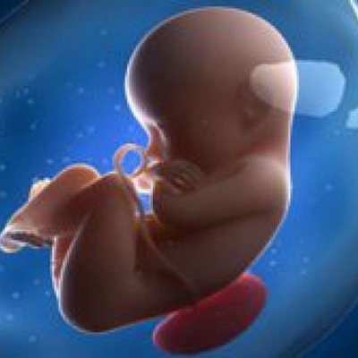 The Fetus That Came Out Of A Woman’s Brain