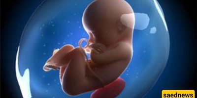 The Fetus That Came Out Of A Woman’s Brain