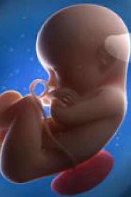 The Fetus That Came Out Of A Woman’s Brain