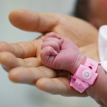 Ultrasound of The World’s Strangest-Looking Fetus Mistaken For a Bird / The Mother Has Had Several Minor Strokes While Waiting For the Baby to Be Born + Photo