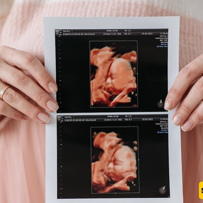 Is An Outbreak of AIDS and Abortions On The Way?