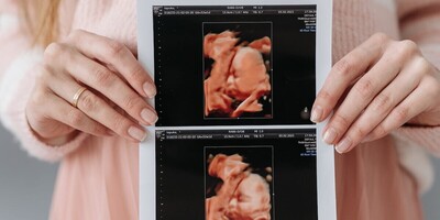 Is An Outbreak of AIDS and Abortions On The Way?