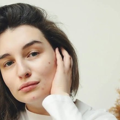Reasons Behind Breakouts in Different Areas of the Face From a Skincare Perspective
