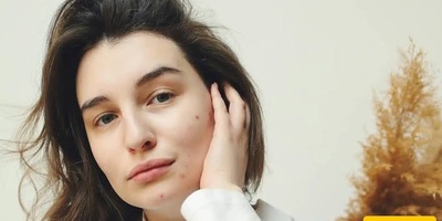 Reasons Behind Breakouts in Different Areas of the Face From a Skincare Perspective