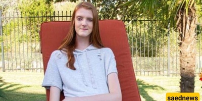 The Challenges Faced by the Woman with the World’s Longest Legs