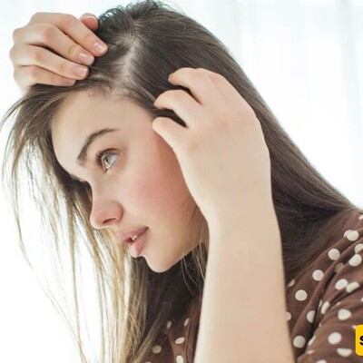 6 Incredible Ways to Treat Temple Hair Loss in Men and Women