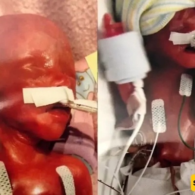 The Strangest Birth in History: This Woman Gave Birth to a Red Apple