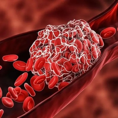 Does Stress Make Blood More Prone to Clotting? / The Effect Anxiety Has on Your Blood in Just Minutes Has Surprised Doctors