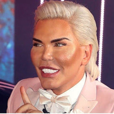 India’s Most Dangerous Eye Cosmetic Surgery: How Far Can Foolishness Go?!