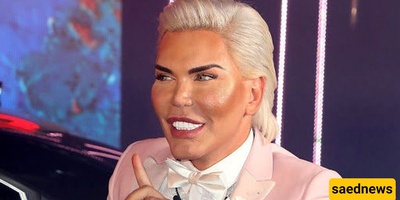 India’s Most Dangerous Eye Cosmetic Surgery: How Far Can Foolishness Go?!