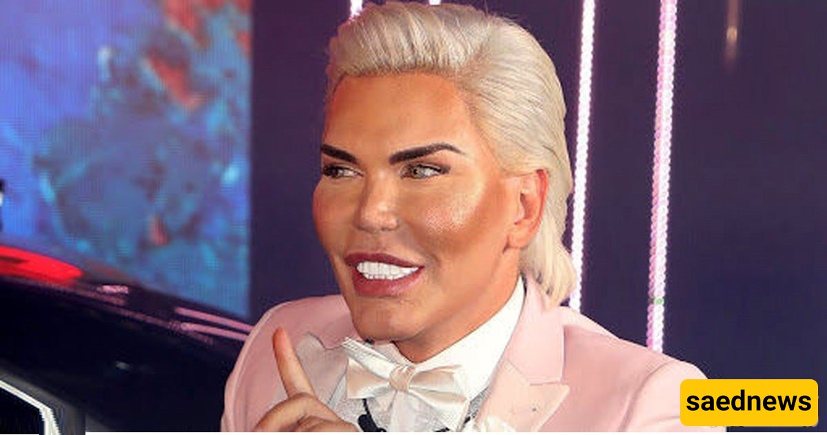 India’s Most Dangerous Eye Cosmetic Surgery: How Far Can Foolishness Go?!