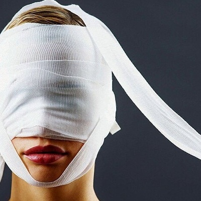 The Heartbreaking Story of the World’s Most Beautiful Woman After Cosmetic Surgery