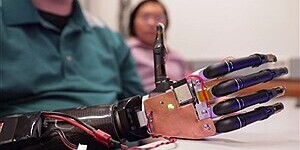 The Challenge of the Human Body and Robotic Prosthetics