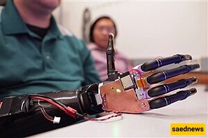 The Challenge of the Human Body and Robotic Prosthetics