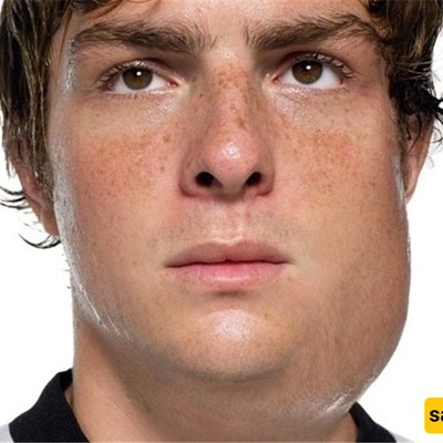 The Strangest Viral Disease That Causes Male Infertility!