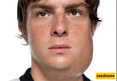 The Strangest Viral Disease That Causes Male Infertility!
