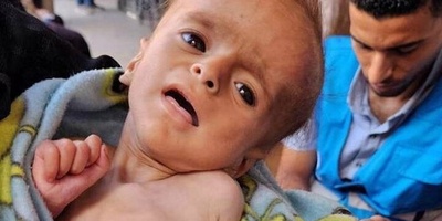 Two More Children In Gaza Die Of Israeli-Enforced Starvation