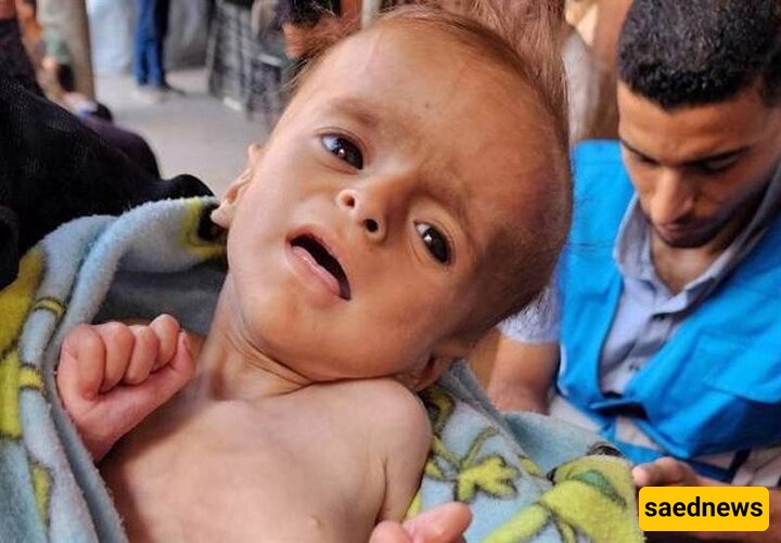 Two More Children In Gaza Die Of Israeli-Enforced Starvation
